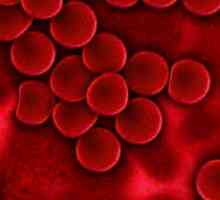 Aglutinaci krve - je ... Krevní skupiny a aglutinace