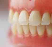Akrylátové zubní protézy: výhody a nevýhody, recenze