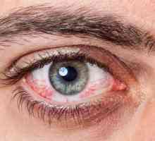 Alergie na oči: jak se chovat, účinné metody a doporučení