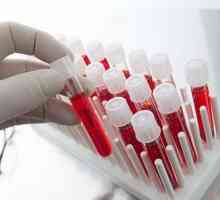 Krevní test na rakovinu. Je možné určit krevní test na rakovinu?