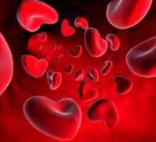 Krevní test: přepis PDW (norm a odchylka)