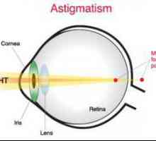Astigmatické kontaktní čočky: funkce, typy a využití technologií
