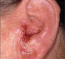 Nemoci ucha lidí: příznaky a léčba