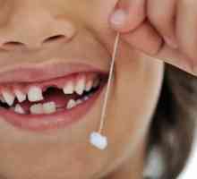 Co dělat, když dítě zuby vypadnou
