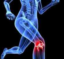 Co je deformovaný artróza kolenního kloubu?
