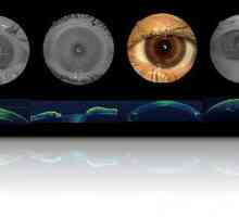 Co je optická koherentní tomografie oči?