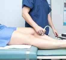 Co je ultrazvuk dolních končetin?