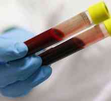 Diagnostiku onemocnění. Biochemický rozbor krve: to ukázat?
