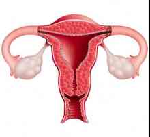 Ovariální dysfunkce: co je to? Příčiny, příznaky a léčebné metody
