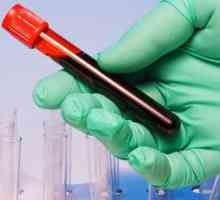 Proč třeba udělat krevní test v onkologii?