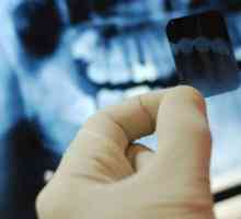 Doklady o daňovém odpočtu pro zubní ošetření. Daňový odpočet implantace zubů