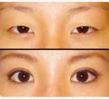 Double očních víček - sen mnoha majitelů asijského vzhledu!