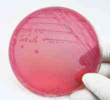 Escherichia coli v nátěru: Jak vážné?