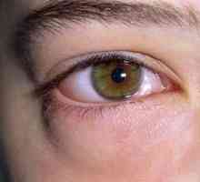 Pokud oteklé oči, příčiny mohou být různé. To platí jak pro dospělé a pro děti