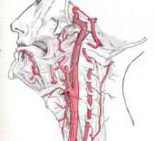 Hypoplazie levé vertebrální tepny. Způsobuje. Příznaky. léčba