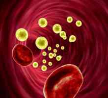 Cholesterol v krvi: míra pro ženy a muže