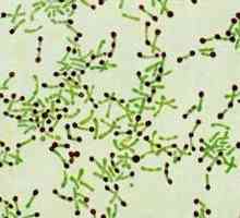 Infekční onemocnění: záškrt patogen