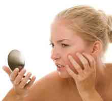 Efektivní mast na podráždění pokožky