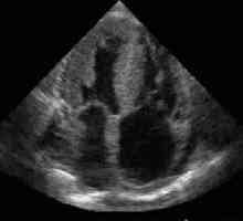 Echokardiografie srdce: rysy tohoto průzkumu a indikace k jeho chování