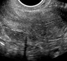 Endometrium od denního cyklu v normálním rozmezí v případě odchylek od něj