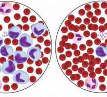 V červených krvinkách se snížila: možné příčiny