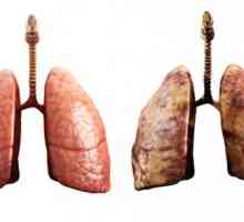 Jak správně léčit zápal plic
