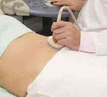 Jak je pánevní ultrazvuk u žen