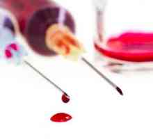 Jak darovat krev na zjištění hormonů, že jo?