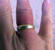 Jak odstranit prsten z rozvodněné prstem sám?