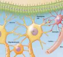Как устроена нервная клетка? Клетки нервной системы