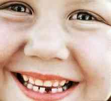 Jaké jsou dětské zuby se mění a v jakém věku?