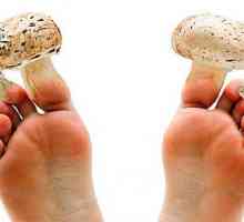 Co lékař léčí nehtů houba na nohou - mykolog nebo dermatologa?