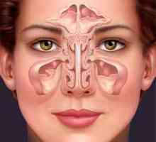 Katarální zánět vedlejších nosních dutin: etiologie, příznaky a léčba