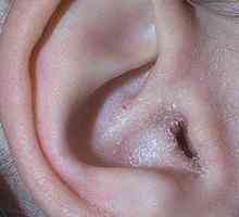 Katarální zánět středního ucha: Příznaky, diagnostika a léčba