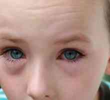 Efektu červených očí dětí - příležitost navštívit očního