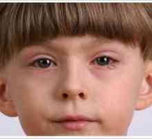 Červené oči dítě: příčiny, léčby a prevence
