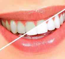 Zuby Vrstvení: popis postupu, komentáře