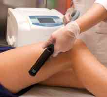 Laserová epilace: Co byste měli vědět o tomto postupu