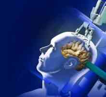 Léčba mozkových nádorů v Izraeli - inovativní metody