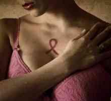 Léčba rakoviny prsu v Izraeli, hlavní rysy