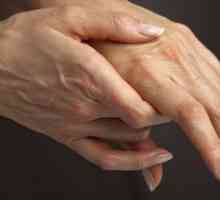 Lék pro kloubů - artritida lék
