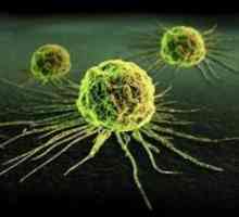 Metody pro detekci nádorových buněk v lidském těle