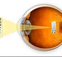 Myopie Oči: symptomy, příčiny, diagnostika a léčba