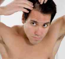 Lidové léky na vypadávání vlasů: recenze mužů a žen