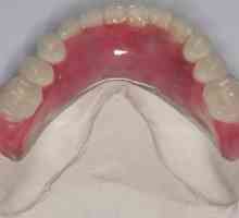 Nylon protéza v nepřítomnosti zubů a částečná. Přehled nylonových protéz