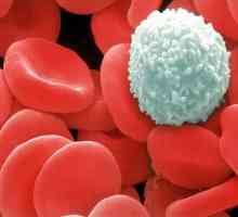 Jak vyplývá z redukovaných bílých krvinek?