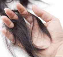 Norma vypadávání vlasů, nebo kolik chlupů denně by měla klesnout?
