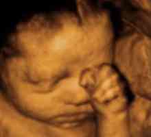 Určování pohlaví dítěte na ultrazvuku, co nejpřesněji