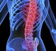 Osteoporóza kost. Hlavním důvodem - nedostatek vápníku
