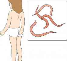 Pinworms na dítě: Metody léčby a prevence nemocí